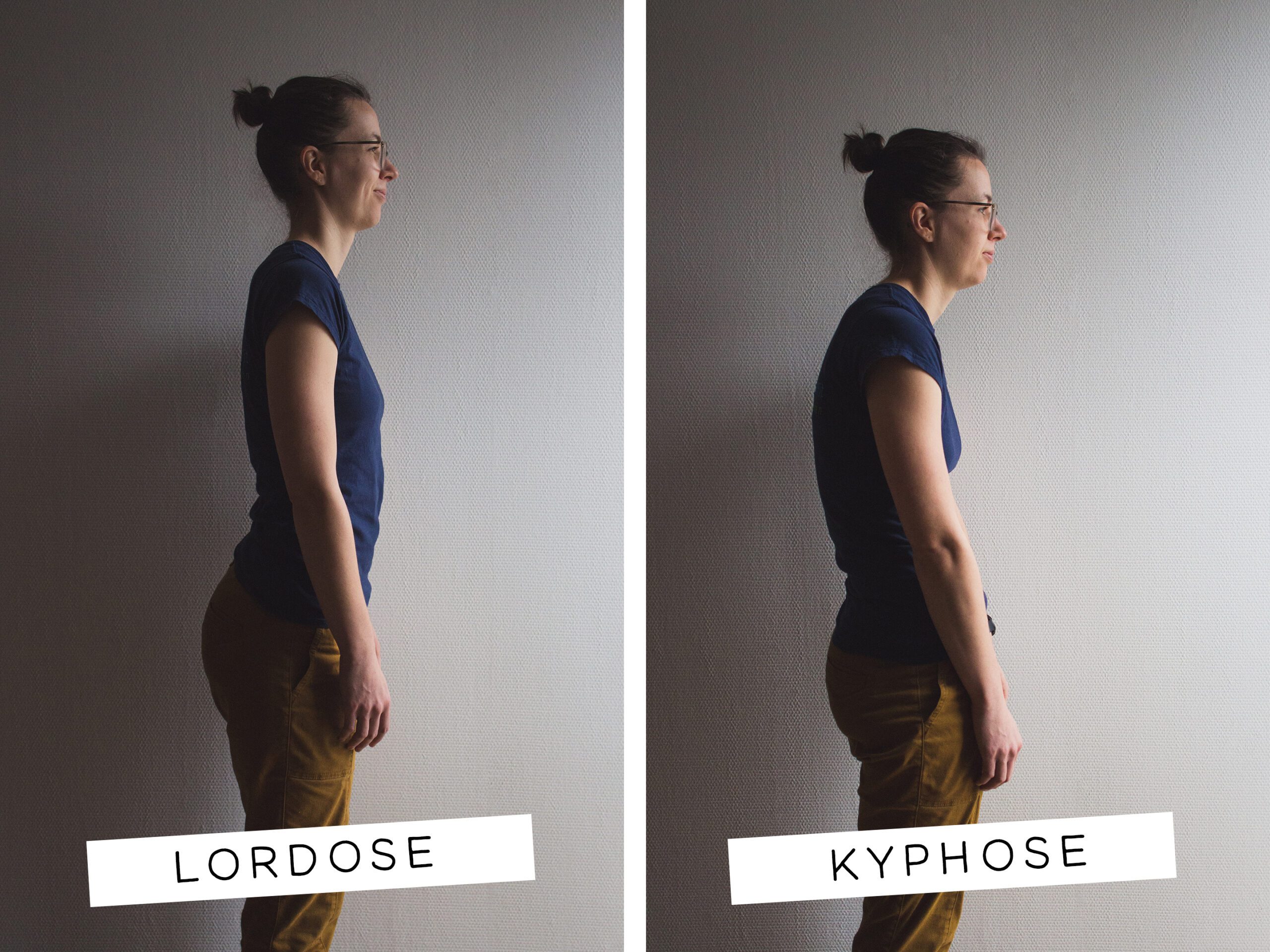 lordose & kyphose